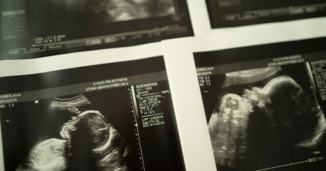 O NIH lança um novo esforço de prevenção de parto multimilionário-ProPublica
