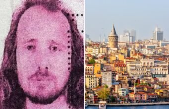 Brit, 36, que morreu poucas horas depois de fazer um transplante de cabelo e tratamento odontológico na Turquia, é retratado Brit, 36, que morreu poucas horas depois de fazer um transplante de cabelo e tratamento odontológico na Turquia, é retratado